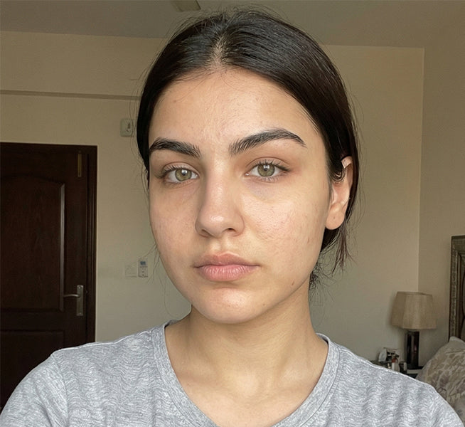 Before — Skin Brightening Serum