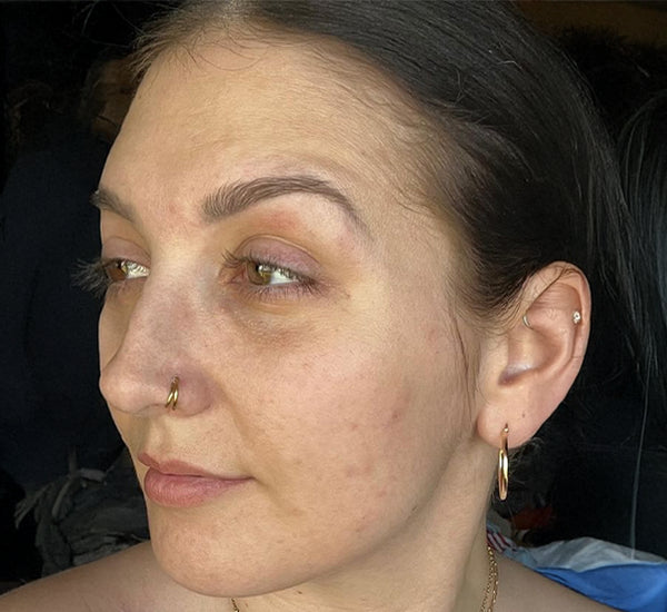 Before - Skin Brightening Cream Gluta Glow with 10% Glutathione, Alpha Arbutin & Kojic Acid for Radiant Skin