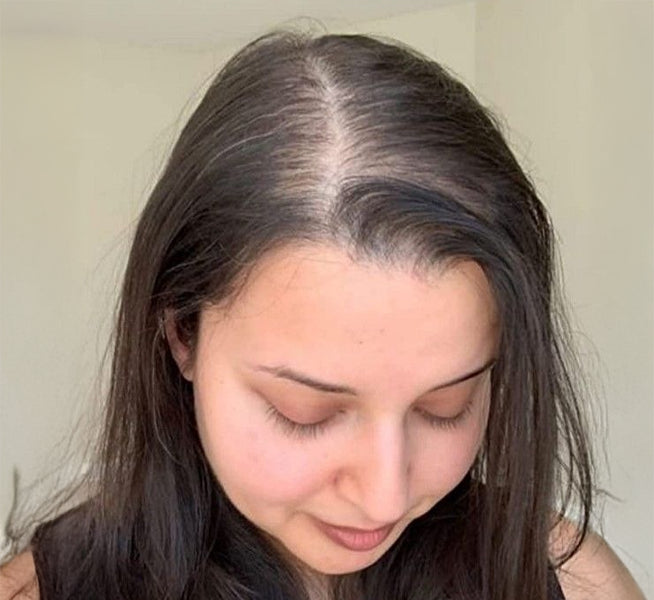 Before — HAIR SERUM